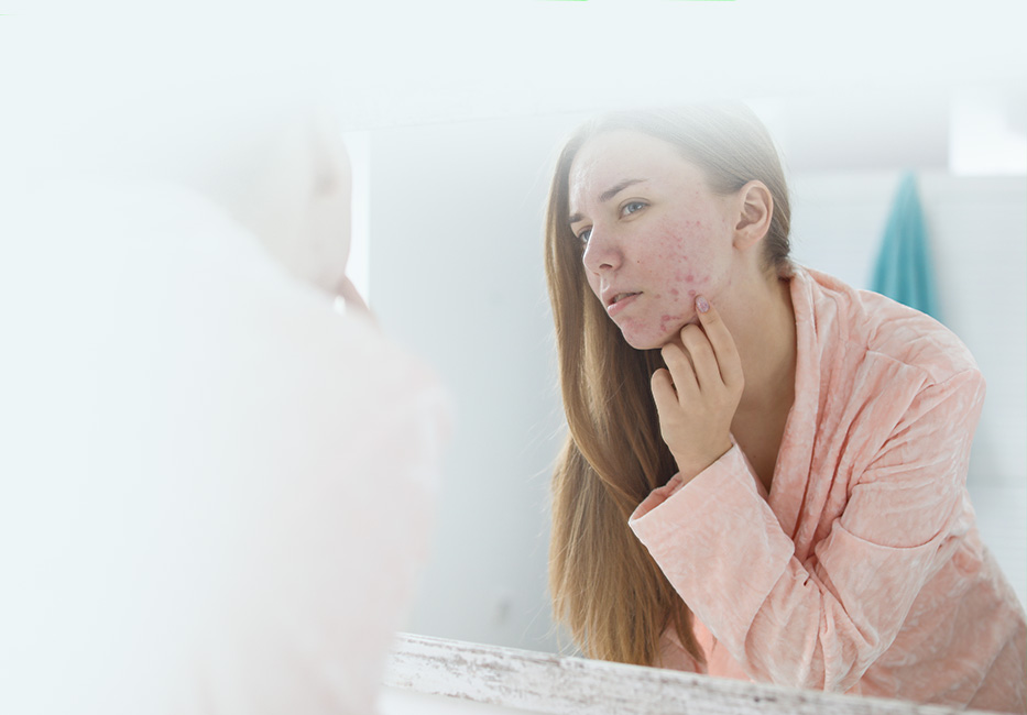 Acne Treatment