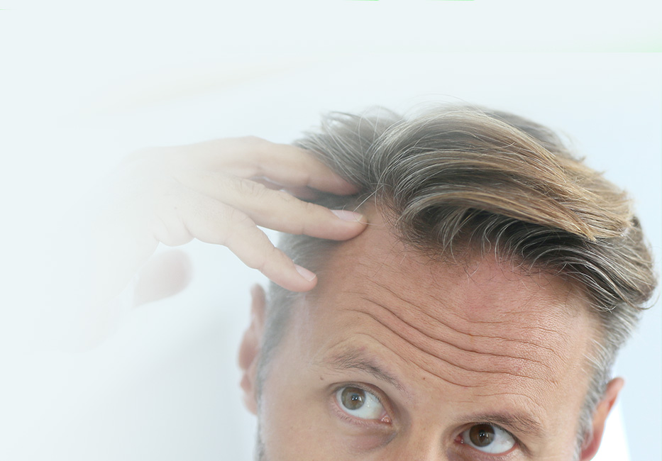 Hair Loss Treatment For Men
