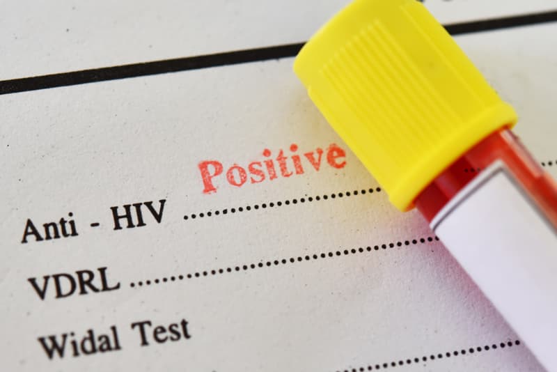 A test analysis of a HIV positive test