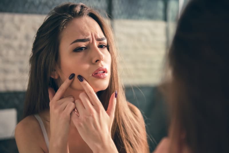 A lady looking at her facial acne in the mirror