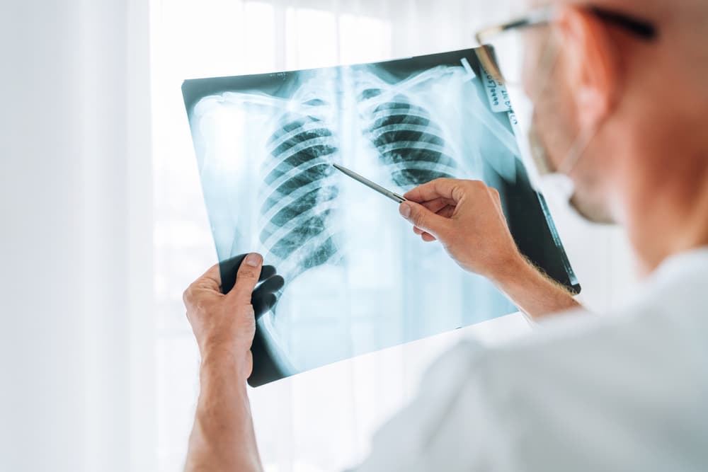 A doctor assessing an x-ray of a set of lungs