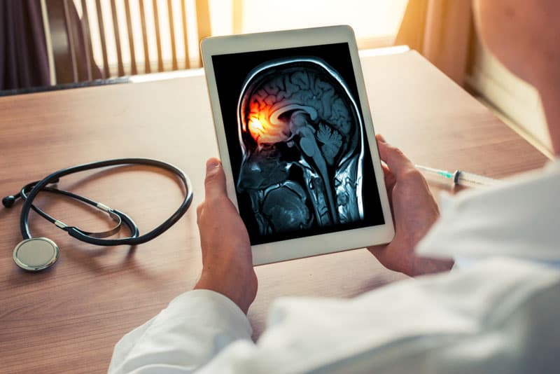 An iPad with a graphic of a brain experiencing a migraine