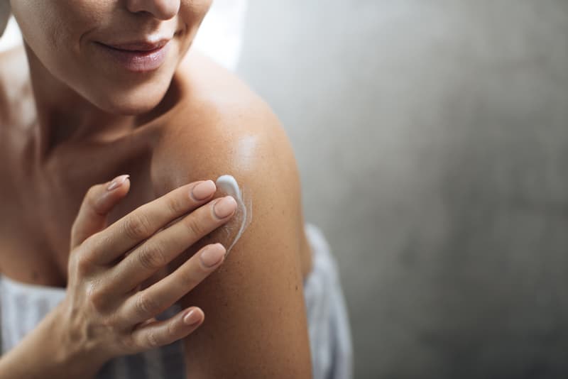A lady applying a topical cream to treat her eczema on her shoulder