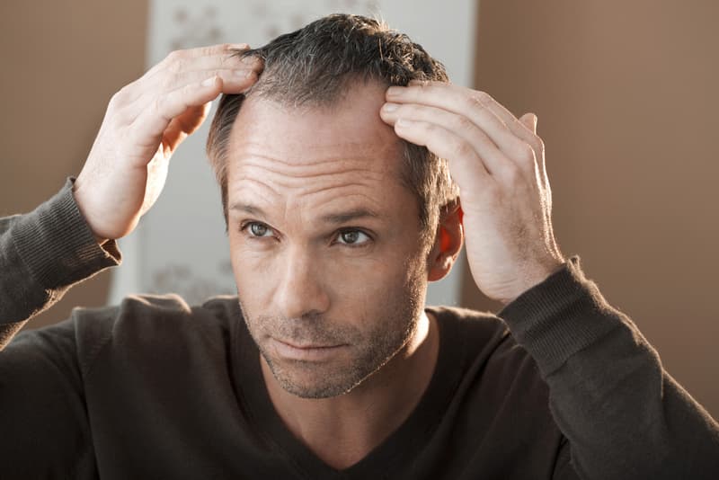 A man checking his hairline