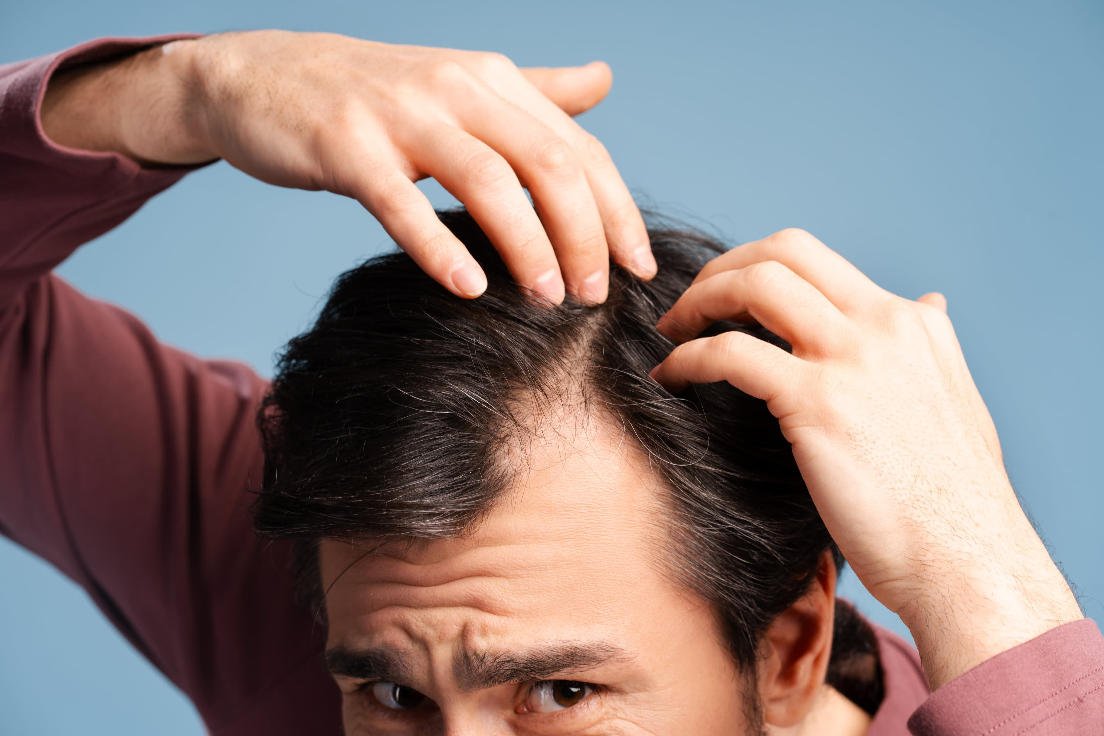 A man assessing his hair line to see if he is losing hair?