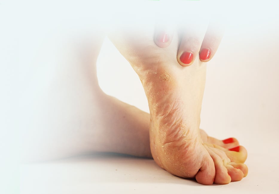 Fungal Infection Treatment