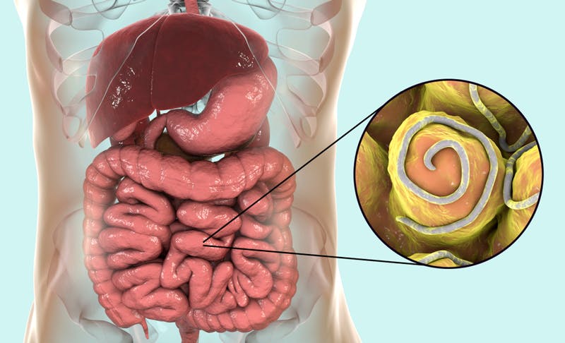 Threadworm inside the intestines of a human.