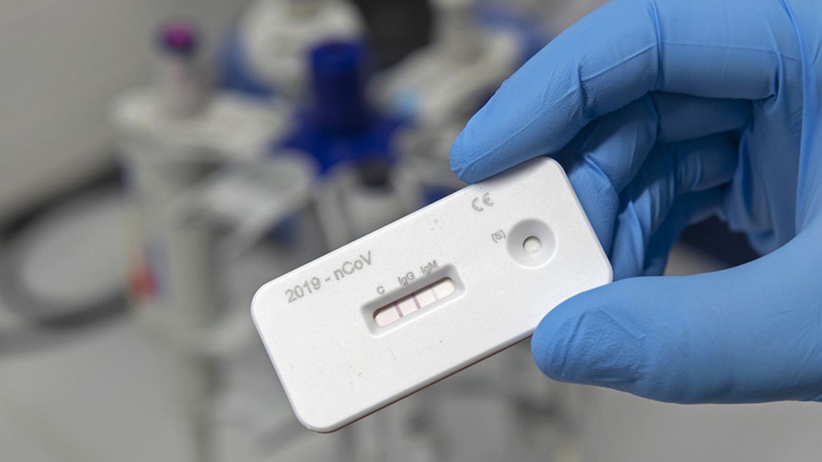 how much are lateral flow tests
