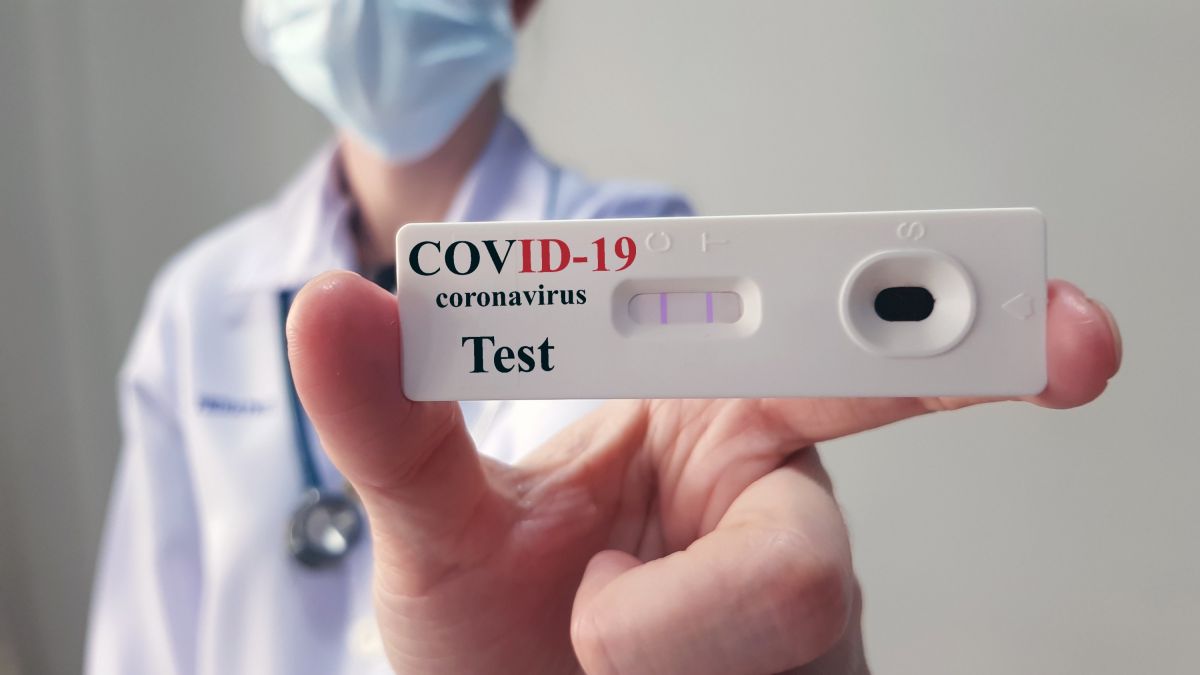 how do I order antigen test