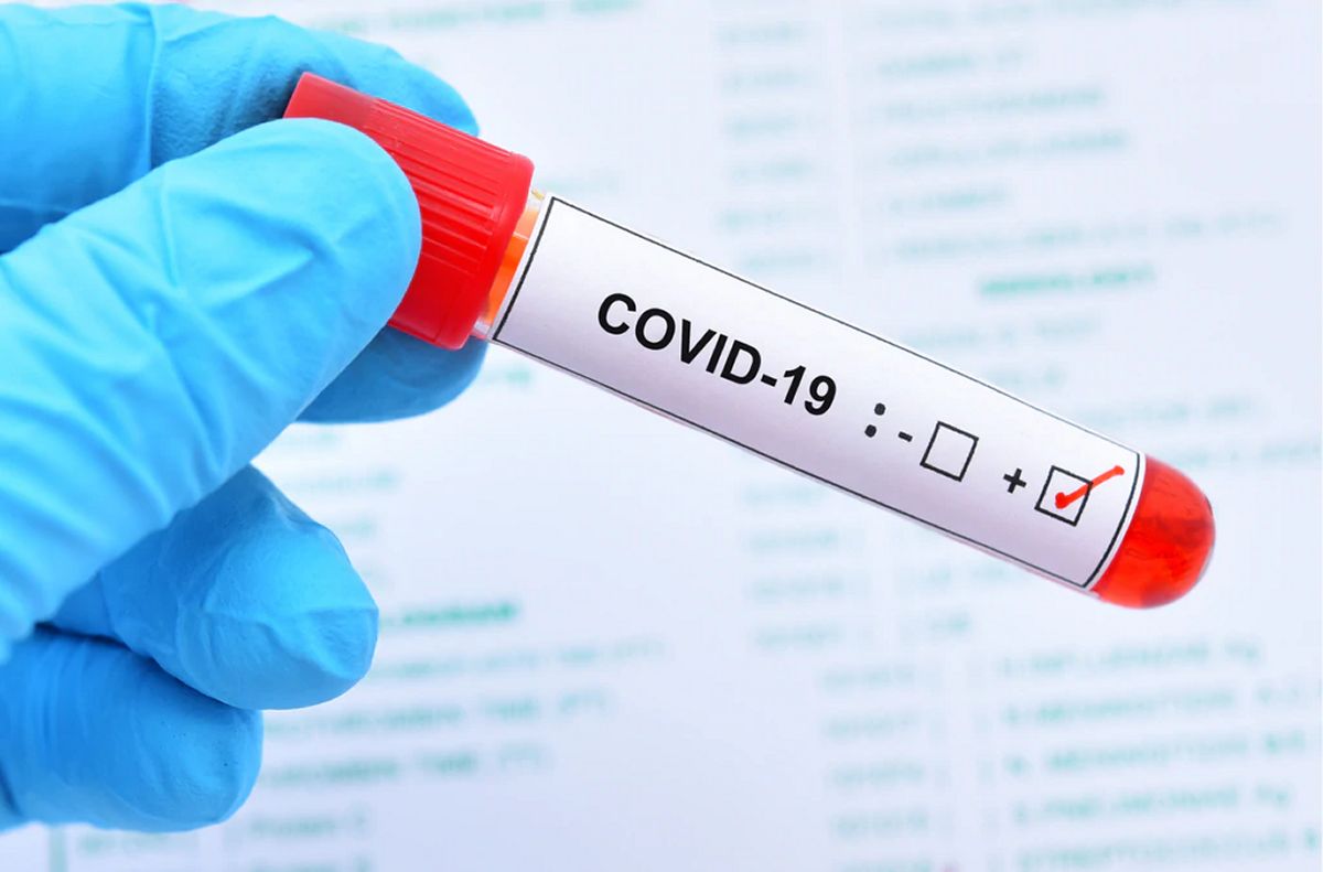 how much are covid tests